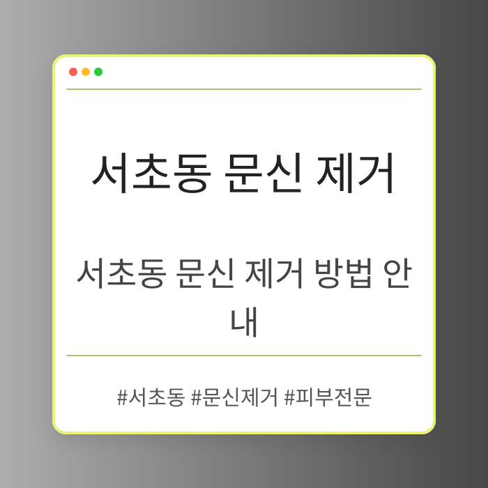 서초동 문신 제거 방법 안내