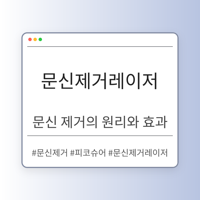 문신제거레이저의 원리와 효과