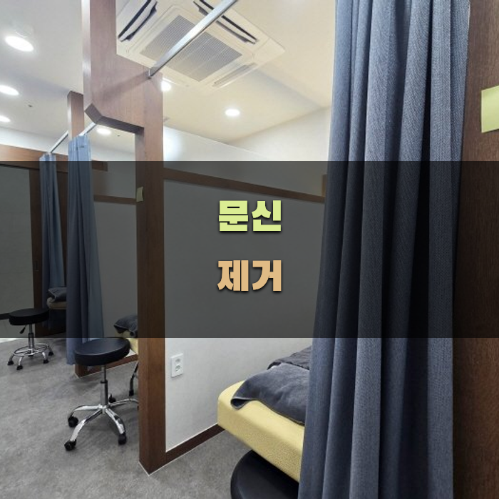 문신 제거를 위한 적절한 절차