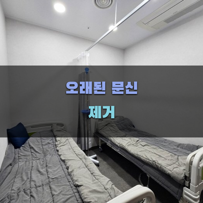 오래된 문신 제거 방법 비교