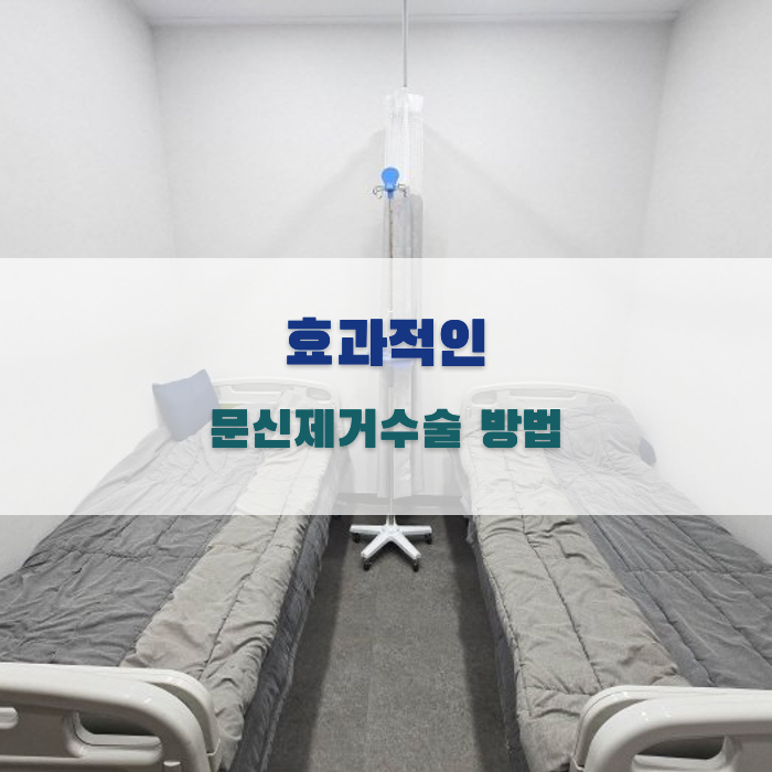 효과적인 문신제거수술 방법