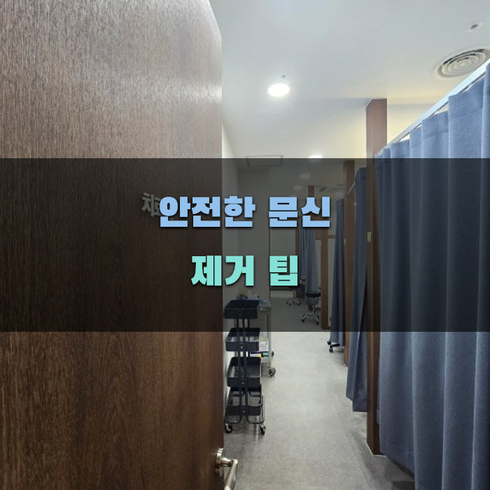 안전한 문신 제거 팁 알아보기