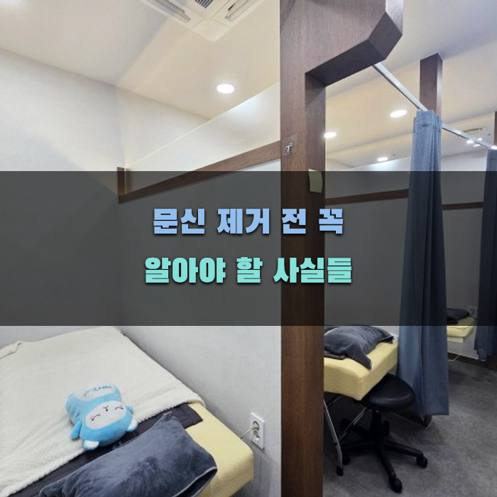 문신 제거 전 꼭 알아야 할 사실들