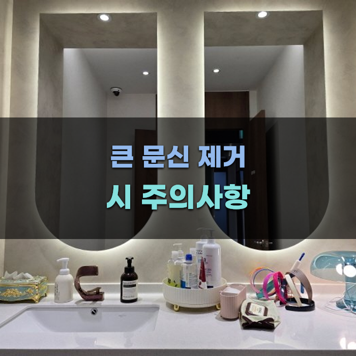 큰 문신 제거 시 주의사항