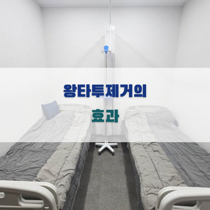 왕타투제거의 효과와 절차 안내