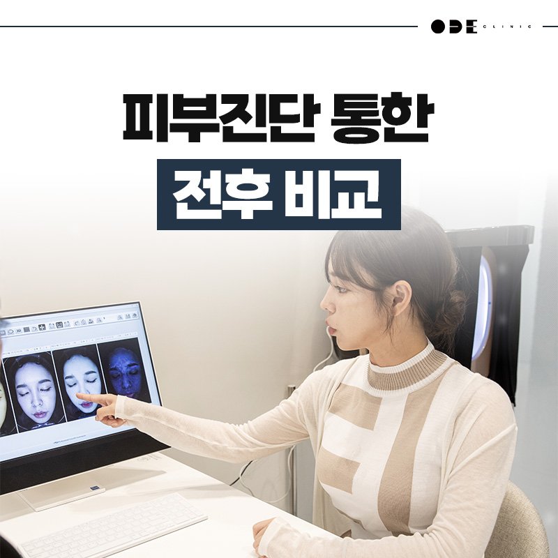 강남 통증 부담 적은 리프팅