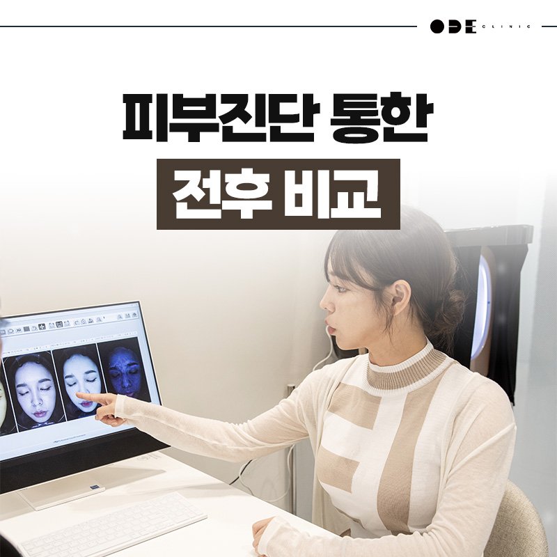 강남 스컬트라 자연스러운 시술